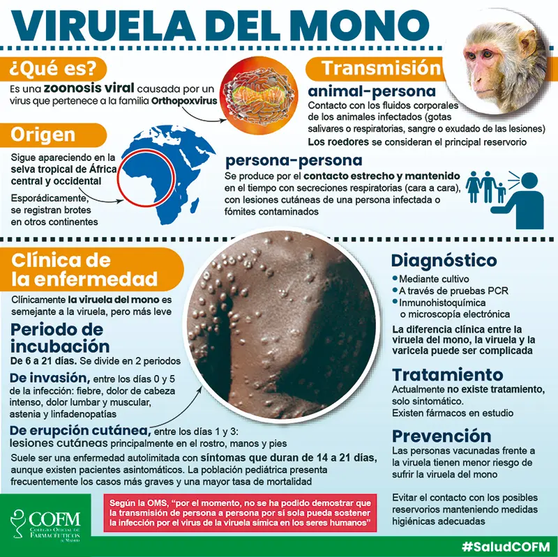 Cartel viruela del mono