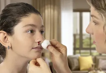 Qué hacer ante una hemorragia nasal