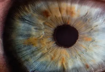 Día Mundial de la Retinosis Pigmentaria, una enfermedad rara