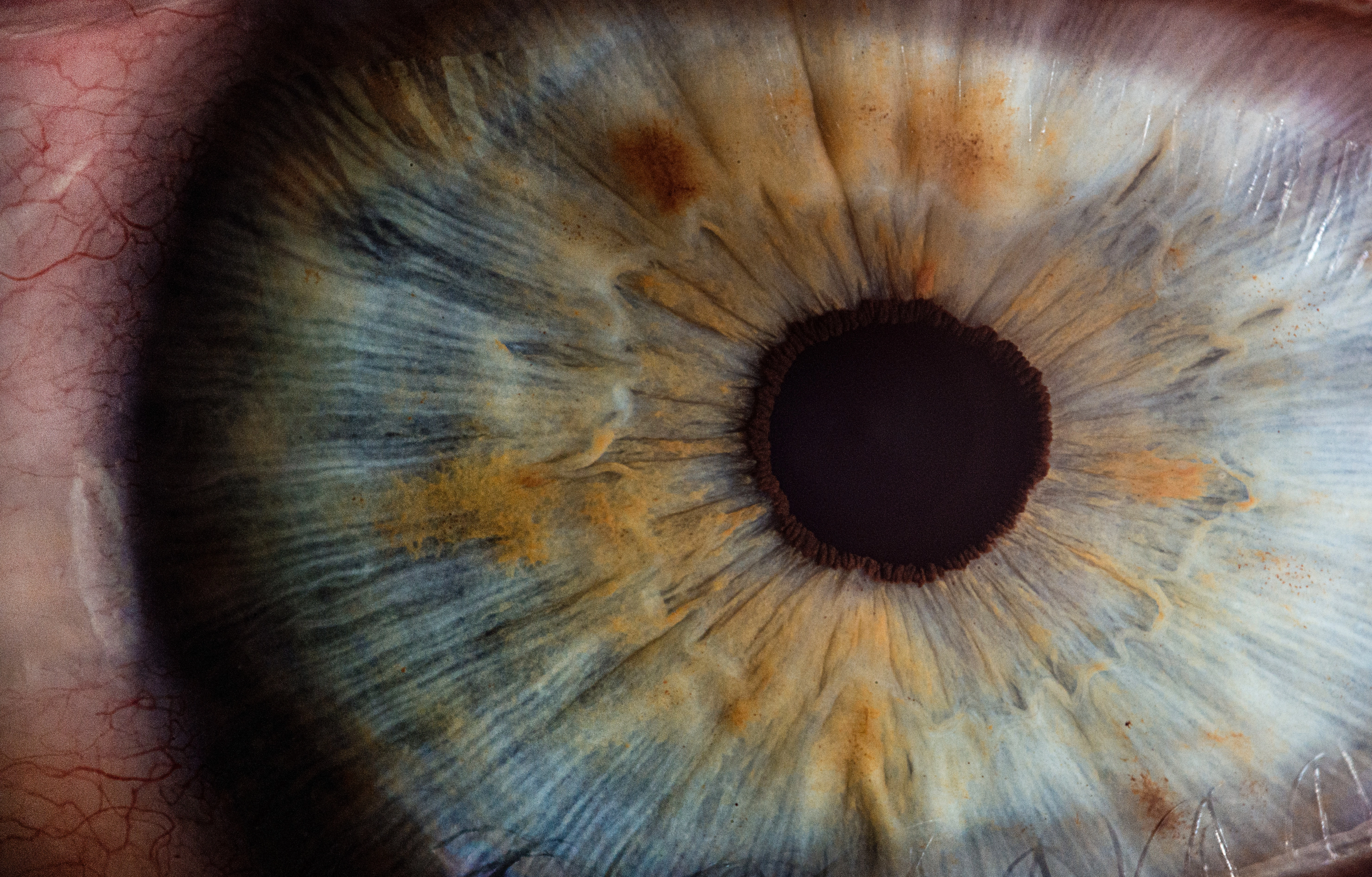 Día Mundial de la Retinosis Pigmentaria, una enfermedad rara