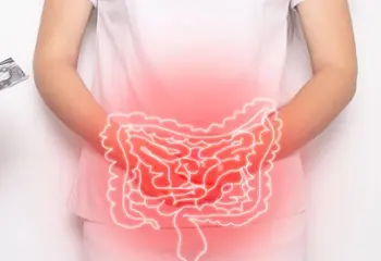 ¿Es lo mismo diverticulosis y diverticulitis?