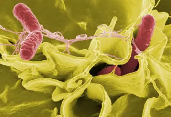 ¡Cuidado con la salmonelosis!