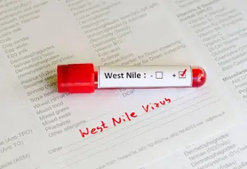 Fiebre del Nilo Occidental (West Nile Fever)