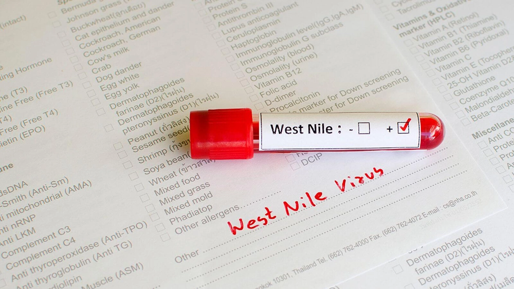 Fiebre del Nilo Occidental (West Nile Fever)