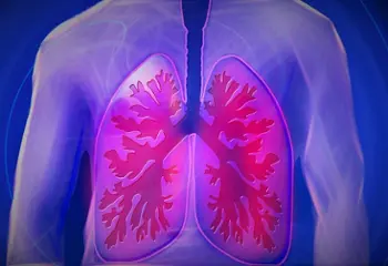Sarcoidosis, ¿de qué estamos hablando?