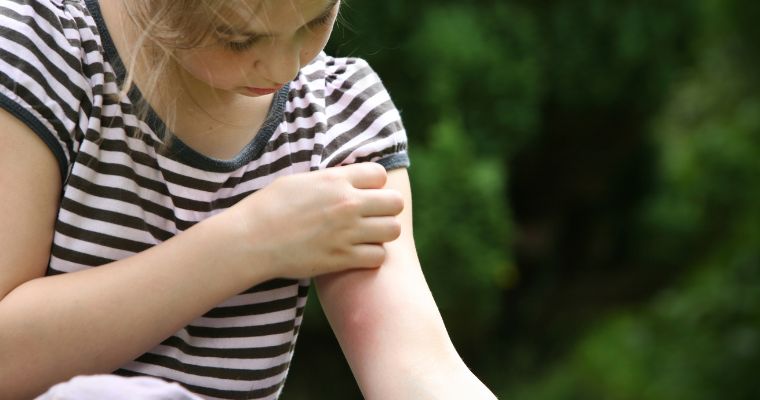 Cómo prevenir y tratar picaduras