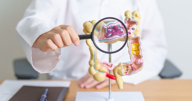 La farmacia, aliado en la prevención del cáncer de colon