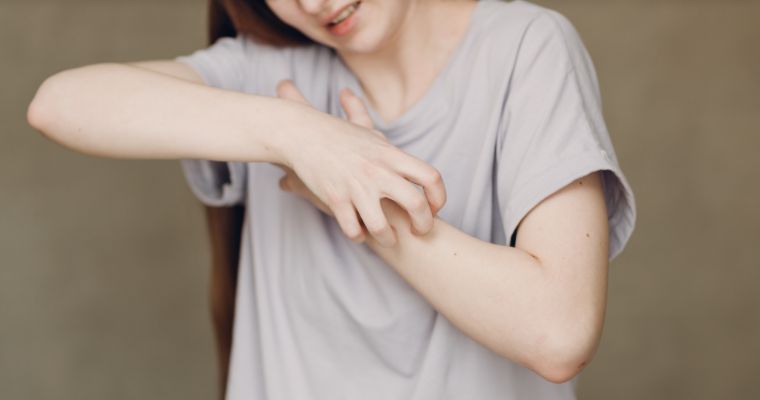 Sarna: contagio, tratamiento y prevención